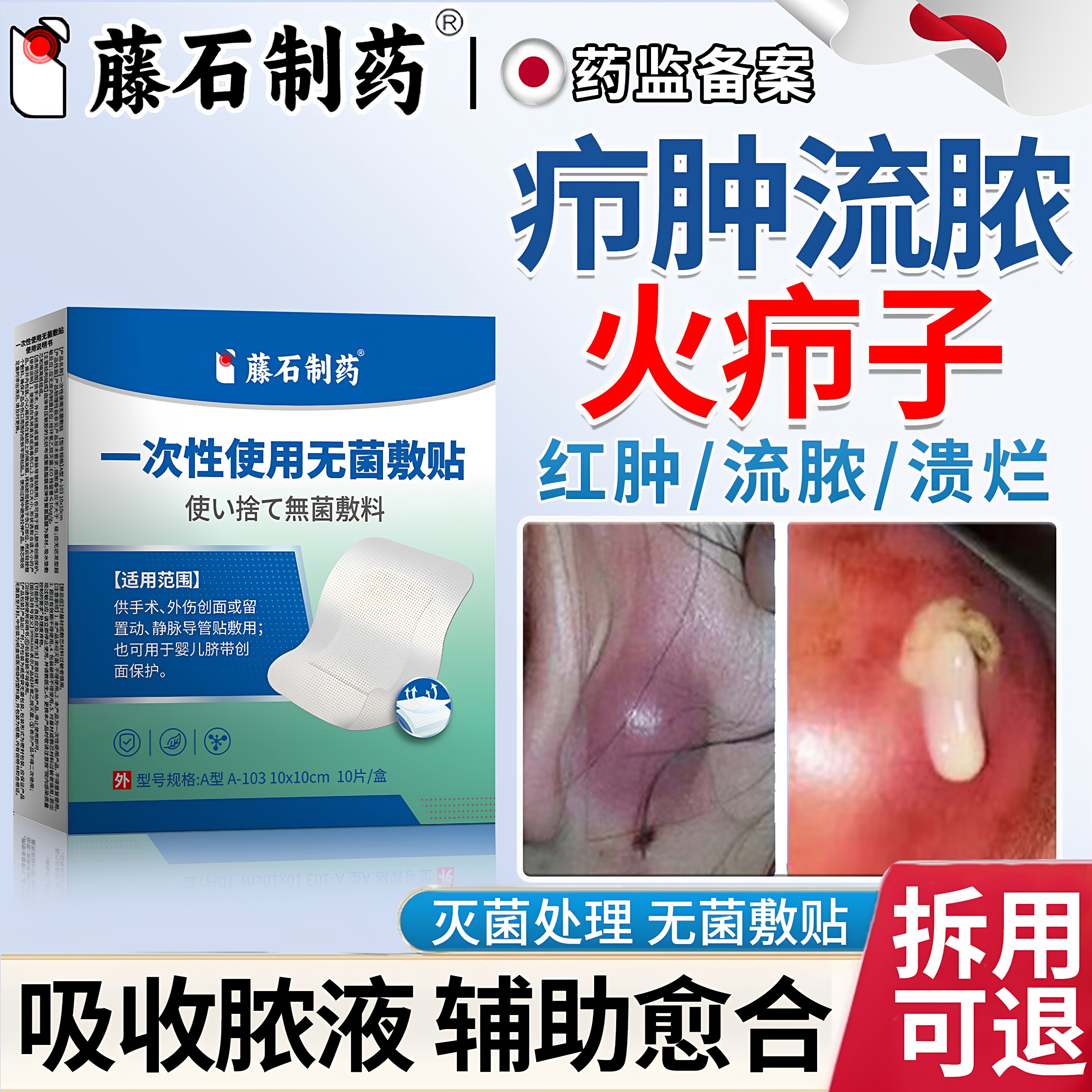 【拆用可退】疖肿医用无菌敷料贴图片