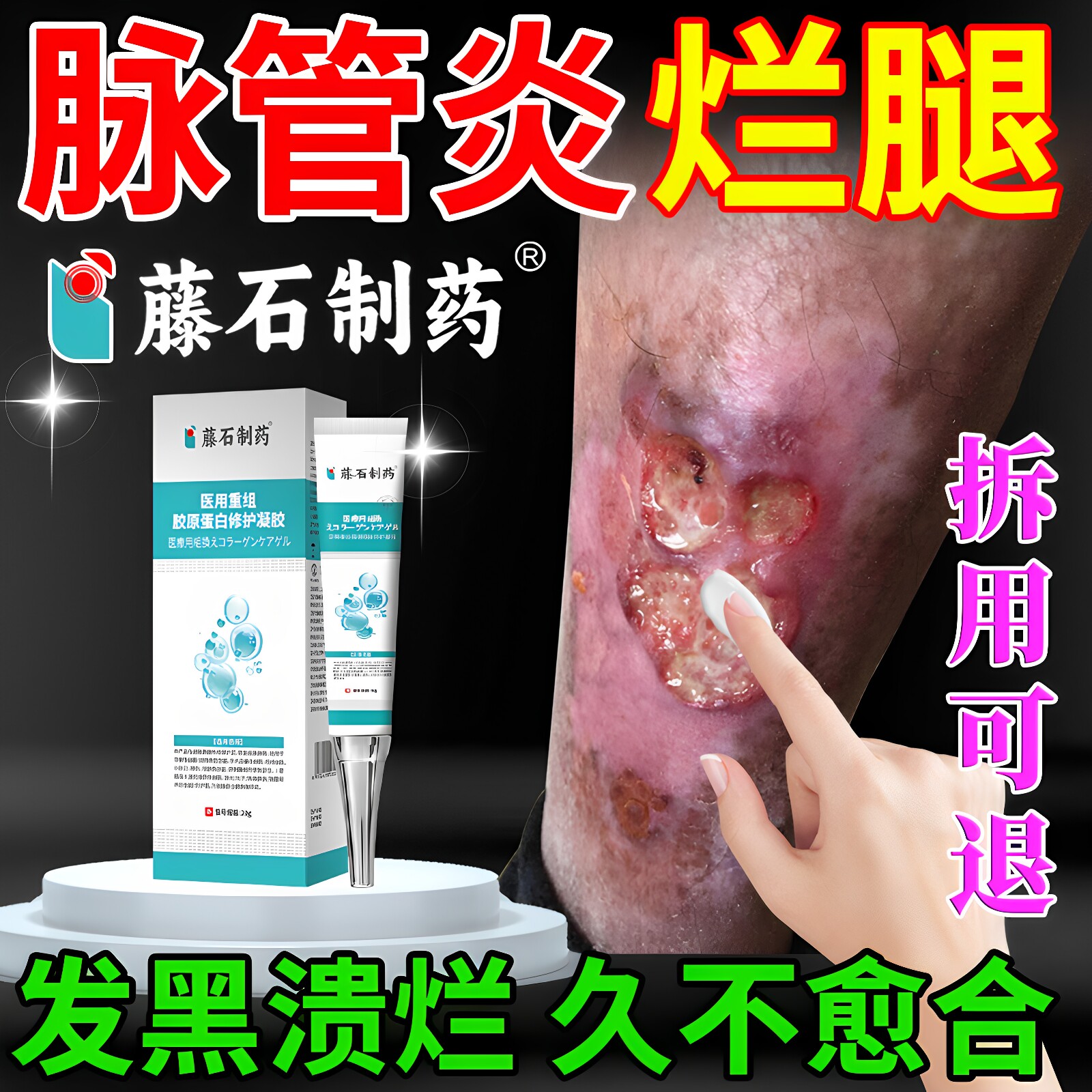 脉管炎老烂腿专用膏伤口不愈合溃烂流脓发黑去腐生肌膏药房同售ZR - 实物图