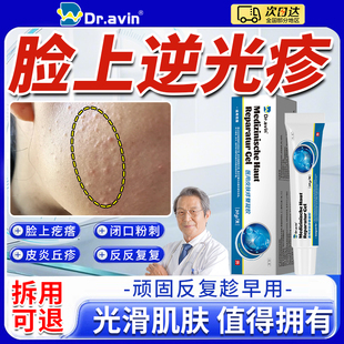 逆光疹修复脸上起小疙瘩额头小颗粒闭口粉刺皮肤屏障修复搭药膏ZR