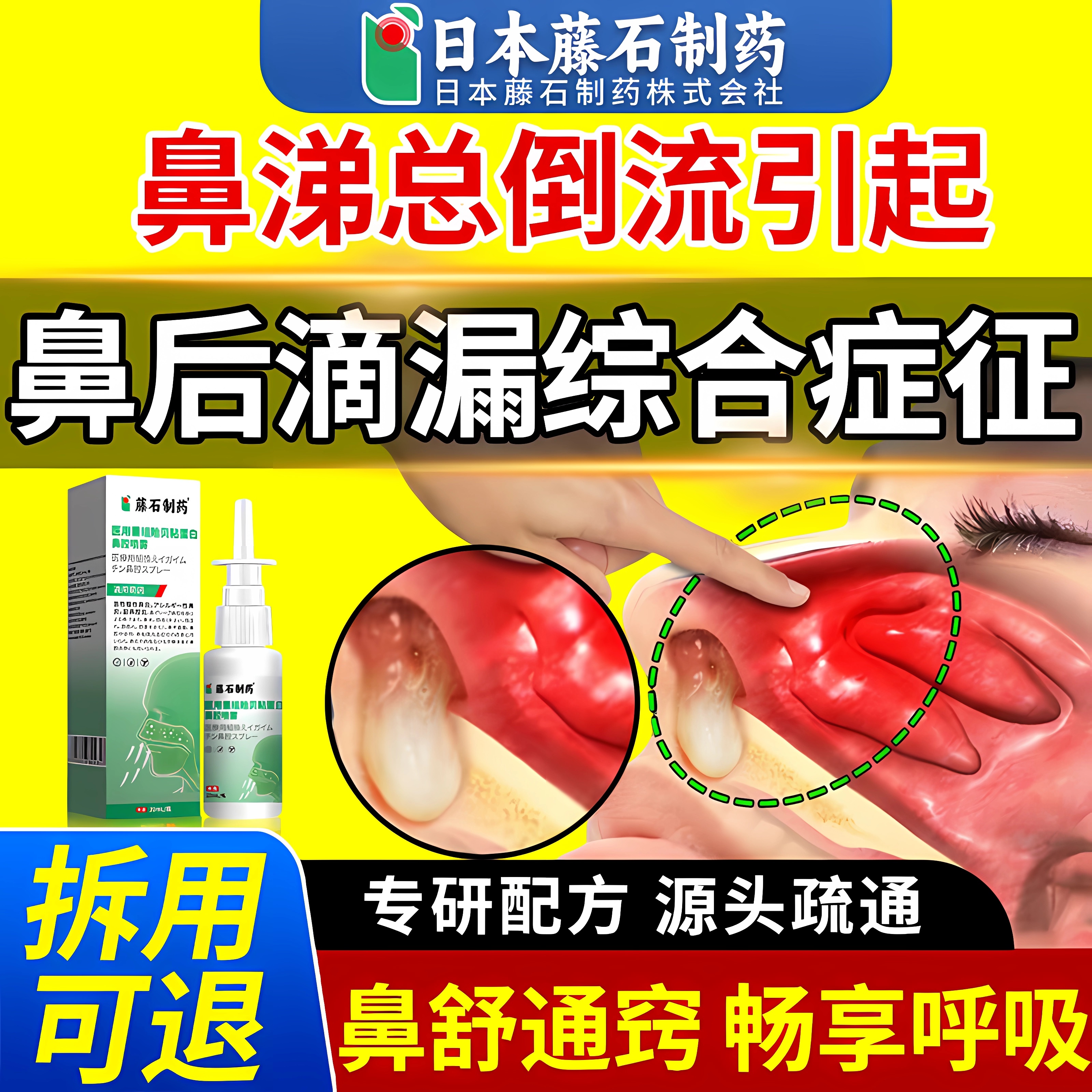 【医用级】鼻涕倒流咳嗽有痰喷剂