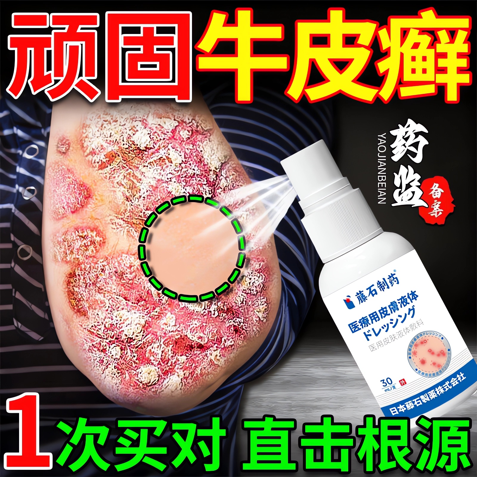 日本牛皮癣银屑病特专用效膏皮肤瘙痒真菌感染去止痒根药房同售ZR