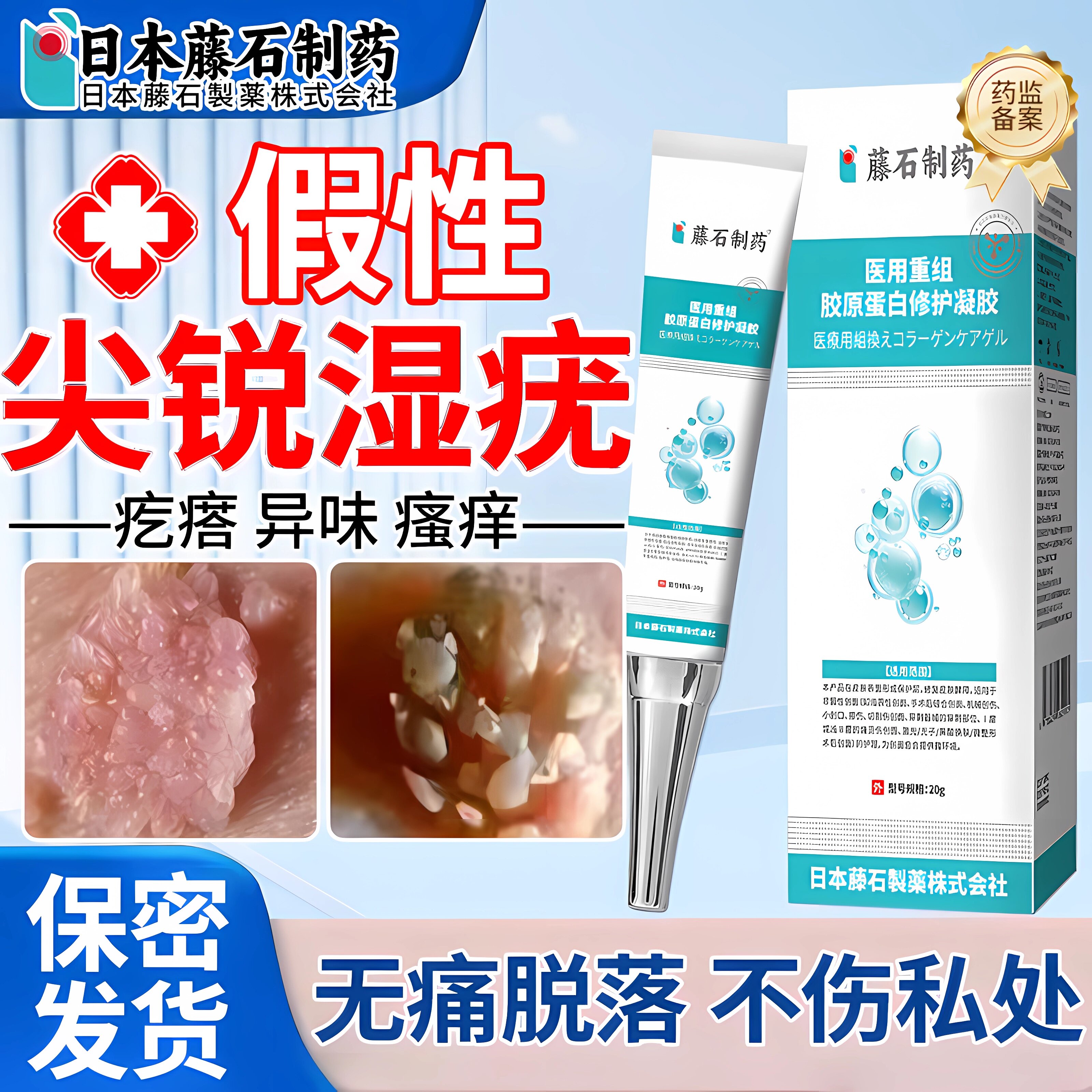 假性尖锐湿疣女性外阴长小疙瘩专用膏抗hpv感染防复发去除神器ZR