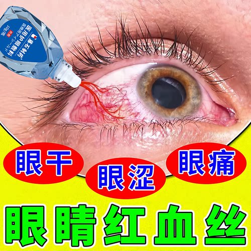 【拆用可退】去眼睛红血丝抗疲劳