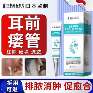 藤石制药先天性耳前瘘管发炎搭药膏耳瘘耳仓发炎流脓清理防水贴ZR