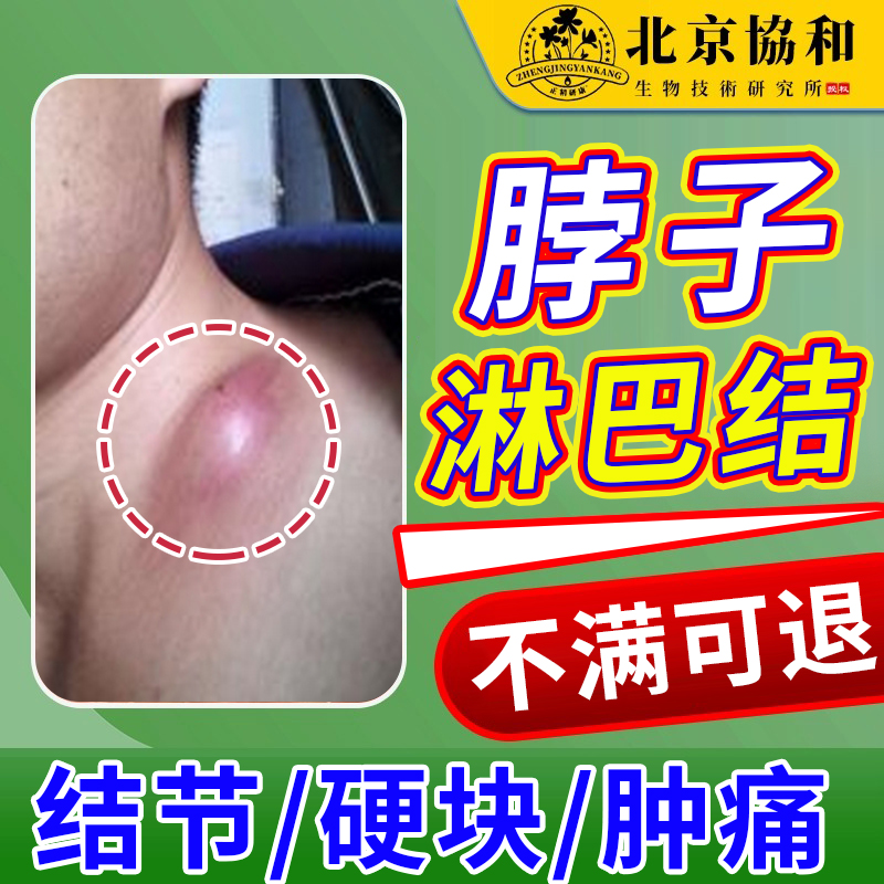 【医用级】硬块肿大吞咽困难囊肿