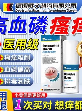 德国监制血磷高全身皮肤干燥引起尿毒症皮肤瘙痒代文拔毒止痒膏ZR