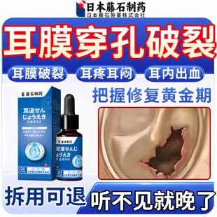 耳膜穿孔修复中耳炎专用可除滴耳液耳朵痒根流脓耳疼耳闷膏药贴ZR