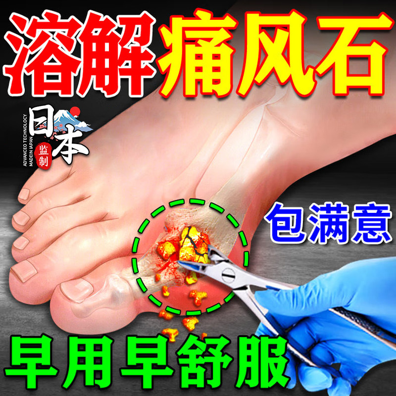 痛风贴止痛溶石降酸尿去结晶膏专治类风湿性关节炎特效
