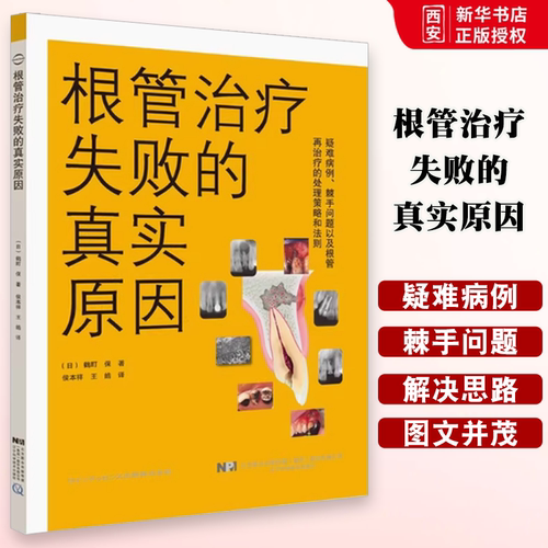 正版根管治疗失败的真实原因 辽宁科学技术出版社 棘手问题以及根管再治疗的处理策略和法则 教程书籍