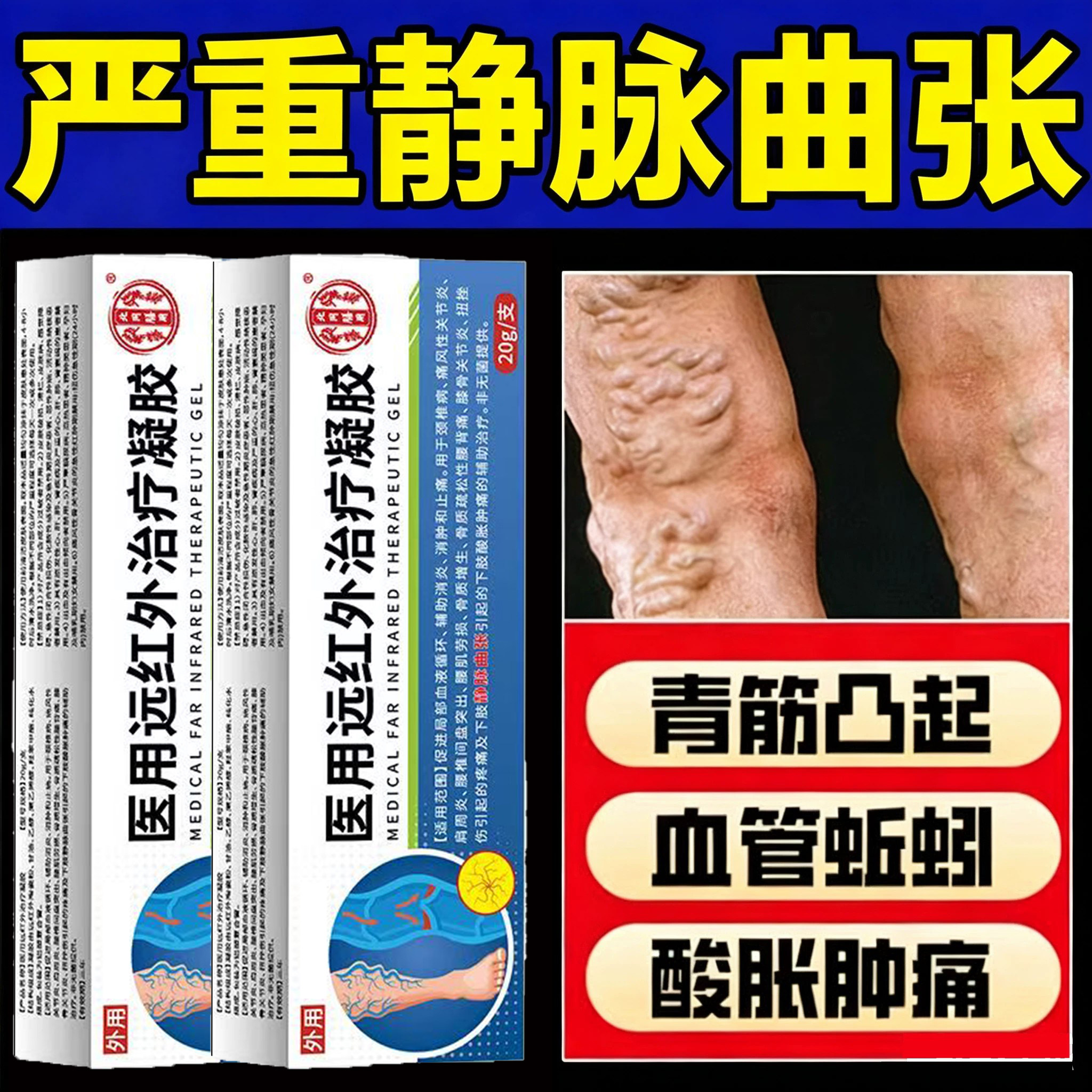 北京同仁堂静脉曲张专用膏青筋凸起红血丝血管堵塞肿胀烂腿热敷膏