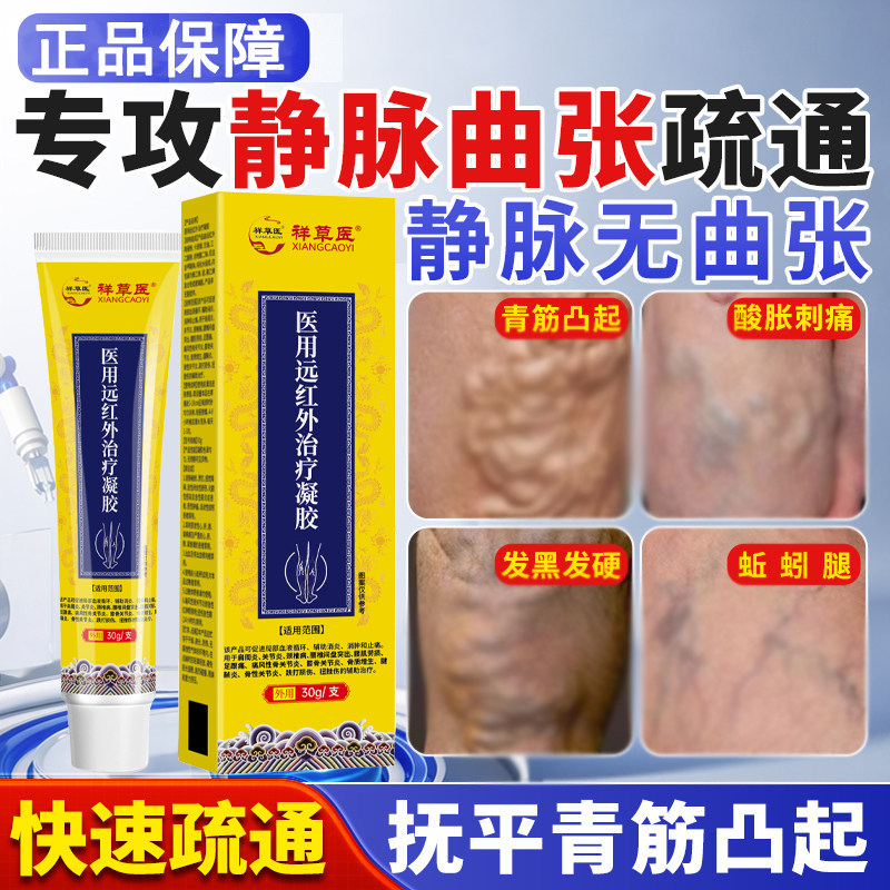 【静脉曲张涂抹专用膏】蚯蚓腿红血丝青筋凸起肿胀痛远红外凝胶型