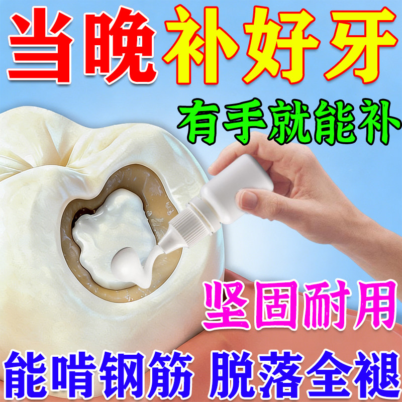 补牙神器进口树脂自己在家补缝隙宽大美国填补充神器永久牙齿烂洞