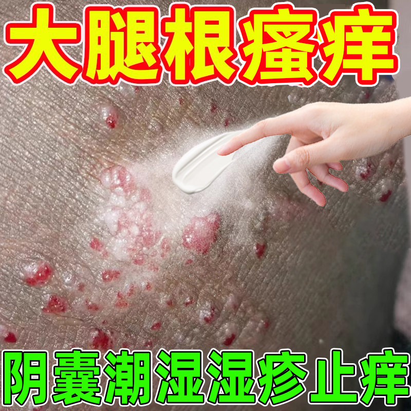 阴囊湿疹瘙痒脱皮男人私处瘙痒阴囊潮湿外用乳膏睾丸私处出汗