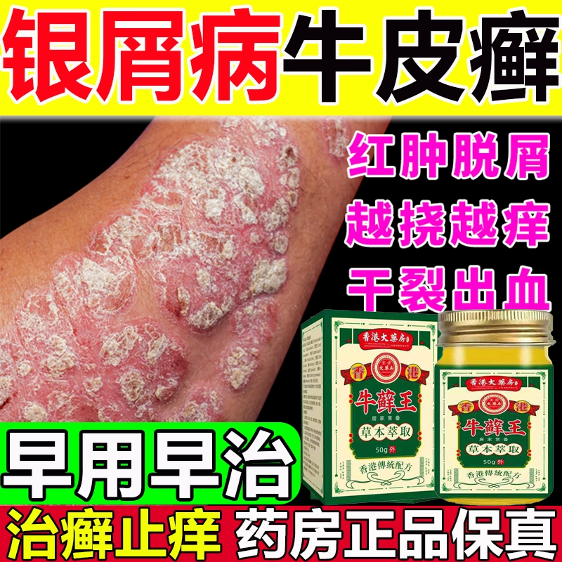 香港大药房牛皮抑菌乳膏正品官方旗舰店专用癣去银屑病止痒药膏
