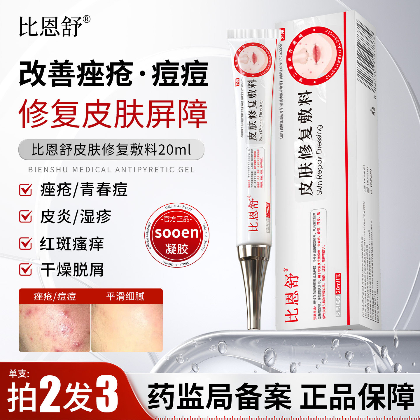 比恩舒sooen皮肤修复敷料改善痘痘痤疮缓解敏感干燥脱屑瘙痒红斑
