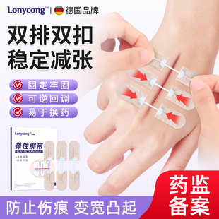 隆畅医用拉链式减张器伤口愈合剖腹产甲状腺儿童手术后疤痕减张贴