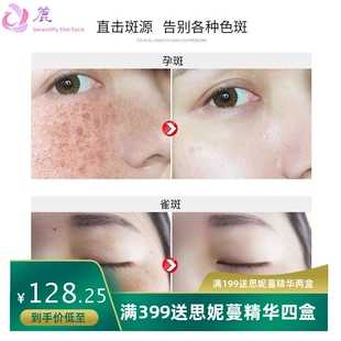 祛斑霜炸斑霜草本美白不脱皮去黑色素祛黄焕回灯泡肌半成品