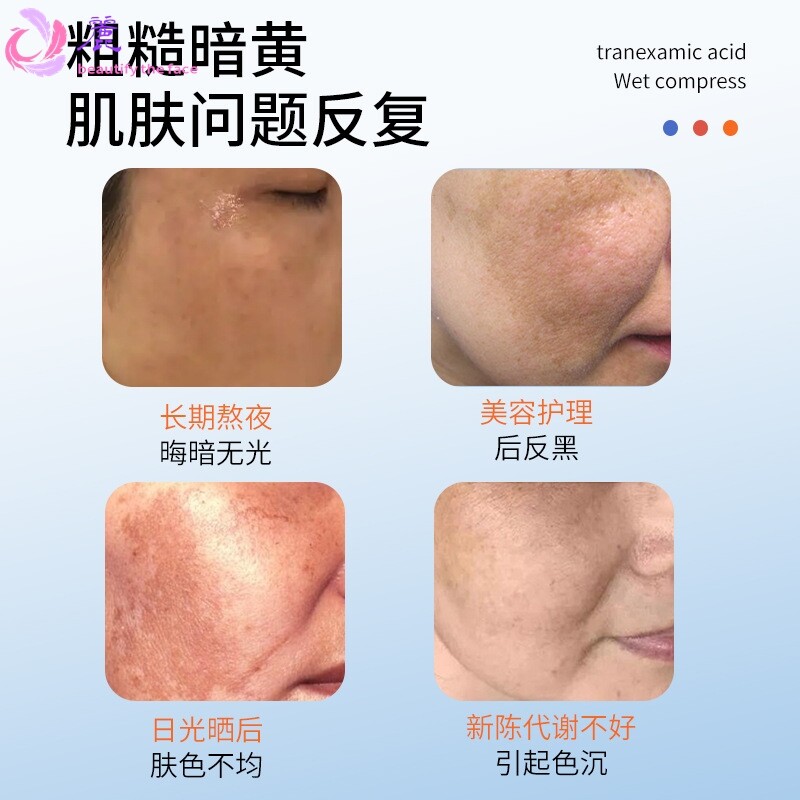 iOEO氨甲环酸湿敷液100ml暗沉黑色素提亮传明酸精华液湿敷水