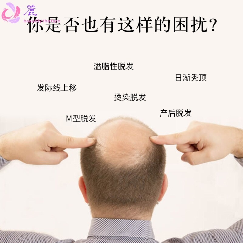 时通防脱精华液增发密发护理液精华喷雾发头发营养跨境