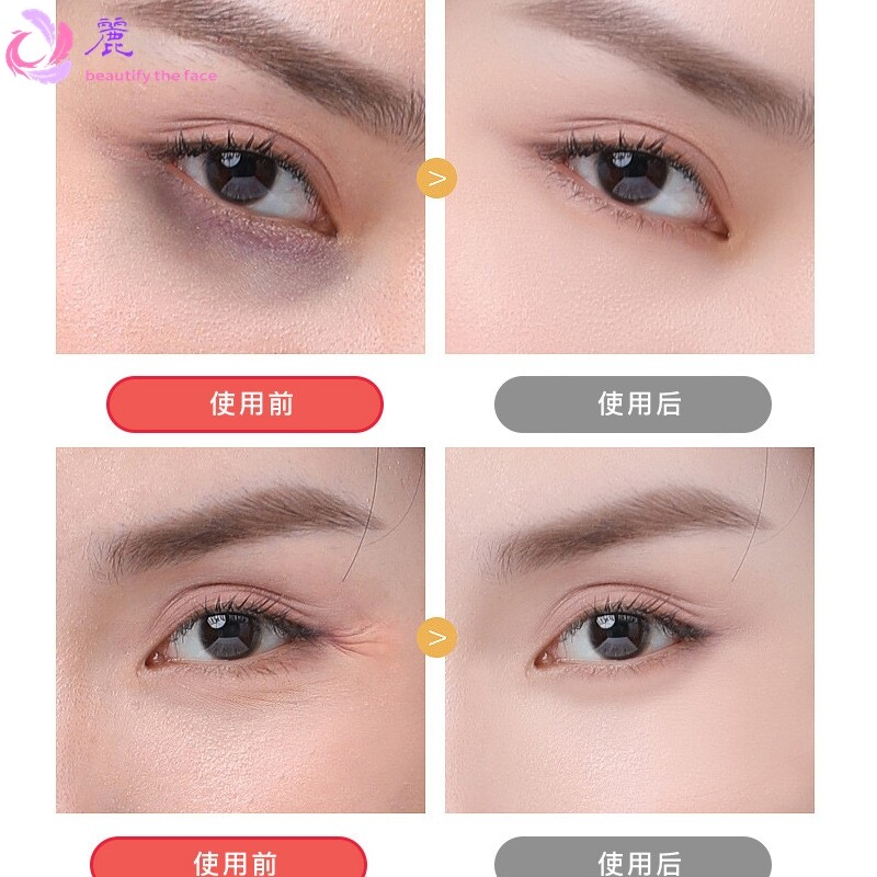高端眼部雾化仪热敷眼部熏蒸仪蒸汽按摩美目仪美容院青少年护眼仪