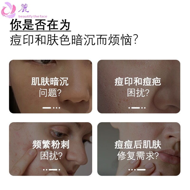 特一美白净痘印精华乳 保湿补水提亮肤色祛痘淡化痘印精华乳现货