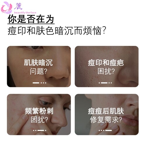 特一美白净痘印精华乳 保湿补水提亮肤色祛痘淡化痘印精华乳现货