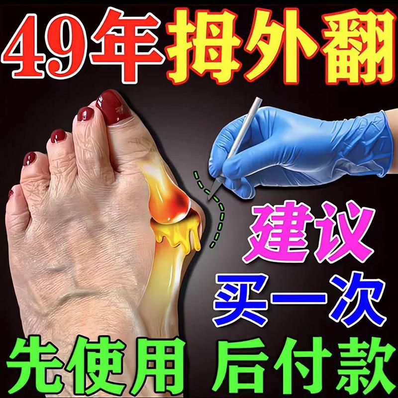 脚拇指外翻矫正器大脚骨宽头脚严重外翻关节痛重叠矫正专用药膏贴