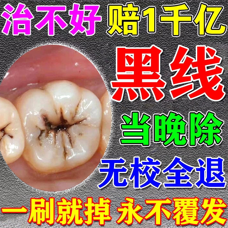 牙膏去黑线黑渍牙窝沟专用清洁牙齿防蛀牙缝发黑菌斑祛除美白神器