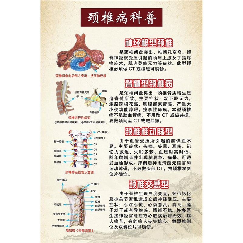 颈椎病科普挂画颈肩腰腿痛海报中医养生馆装饰画颈椎腰间盘图墙贴,家居饰品,软装墙贴,淘宝优惠券,粉丝福利购,淘宝优惠卷
