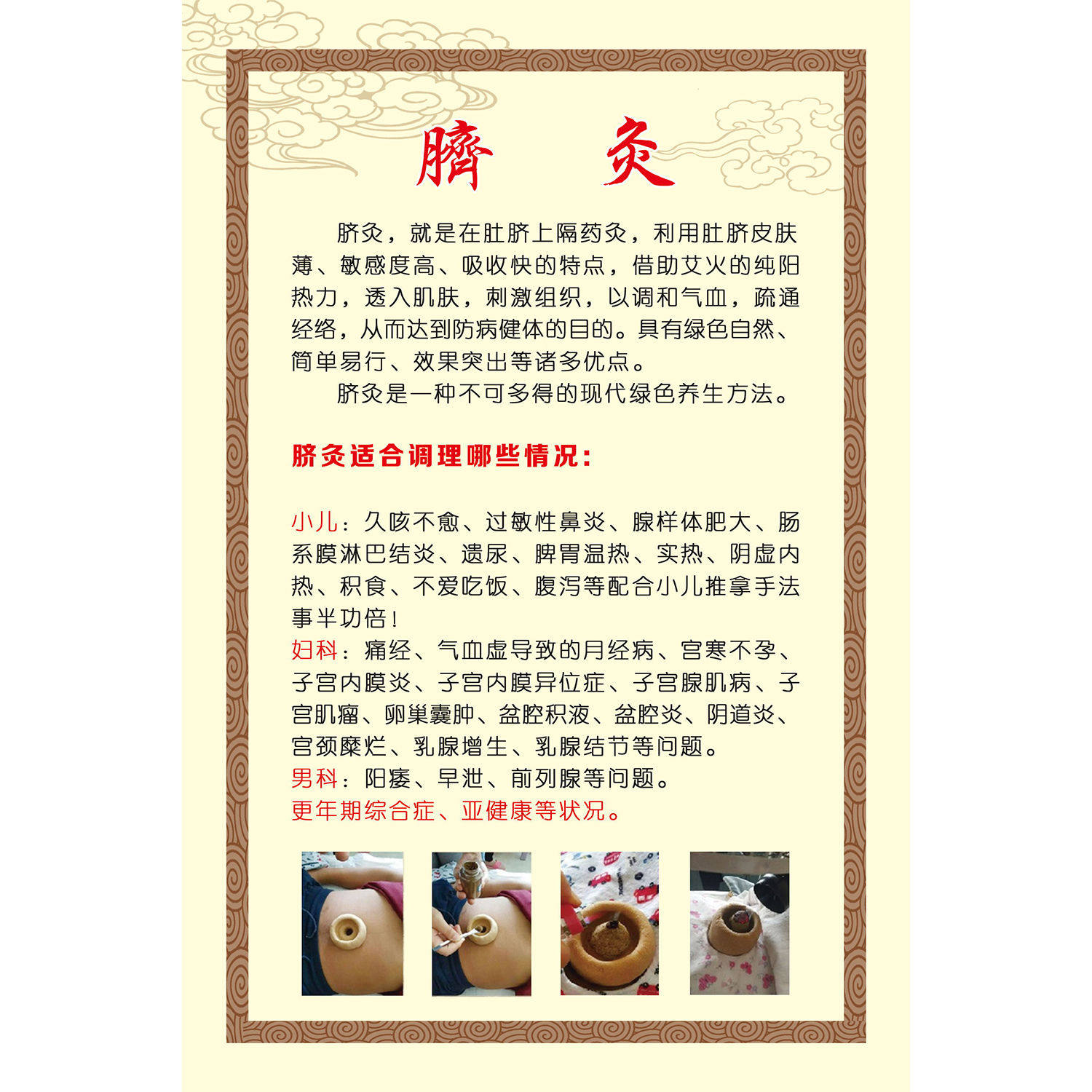 中医养生馆小儿推拿脐灸脐疗写真海报挂图脐灸调理症状墙贴宣传画