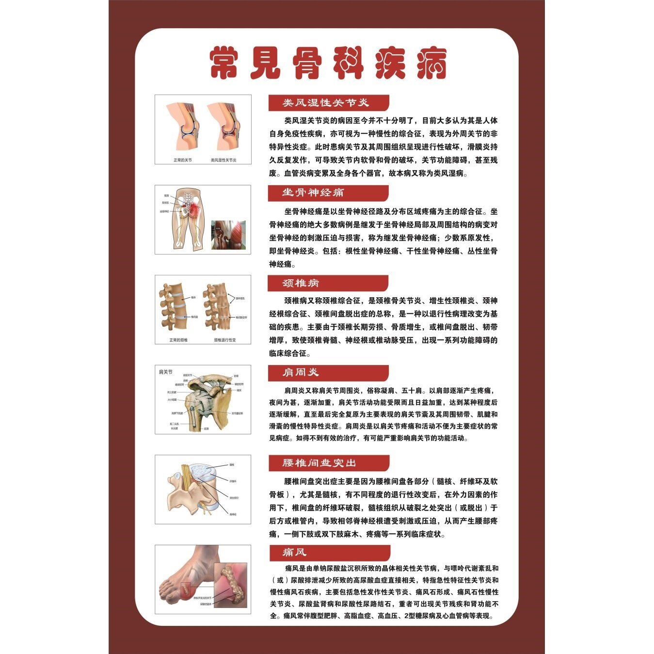 人体骨骼图挂画全身图解医用结构图解剖图海报常见骨科疾病图谱