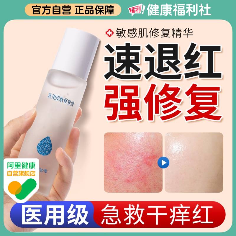 医用敏感肌修复屏障受损