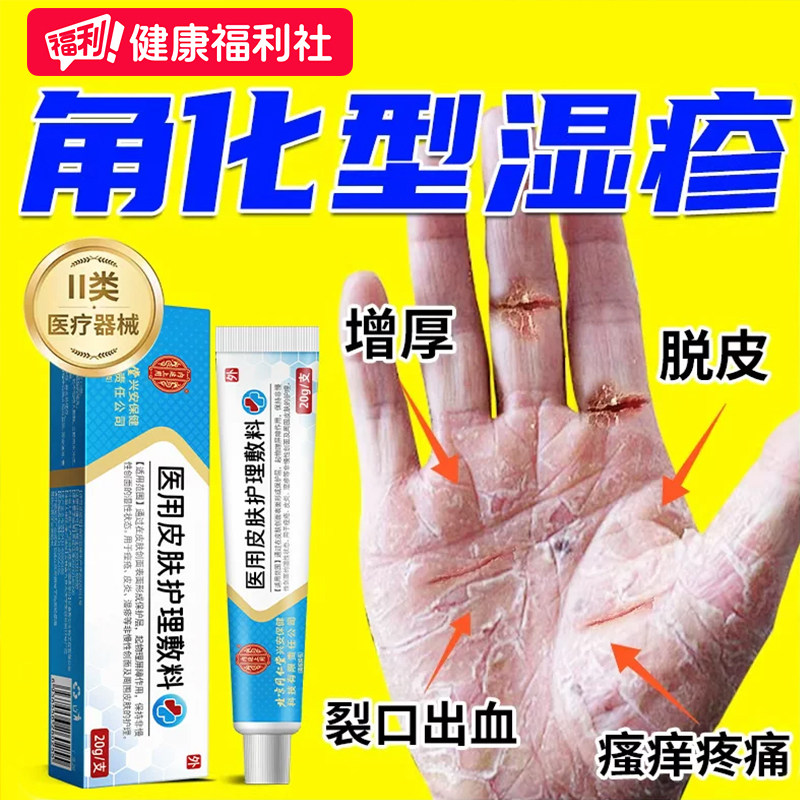 手部角化型湿疹脱皮干裂真菌感染止痒专用非手足癣癣膏药膏皮肤