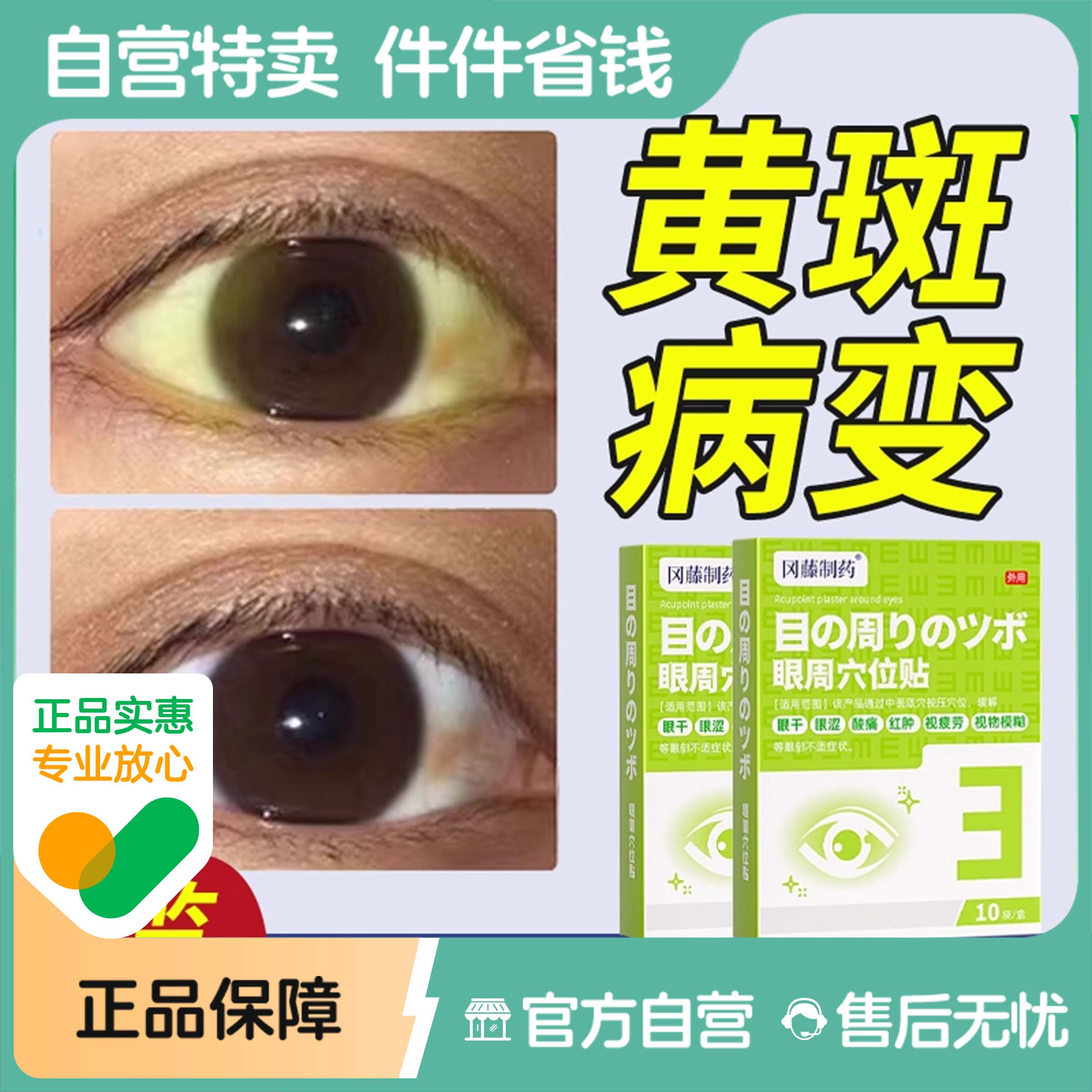 眼底黄斑病变眼贴水肿黄斑眼白清澈去黄贴红血丝眼白发黄眼睑裂斑