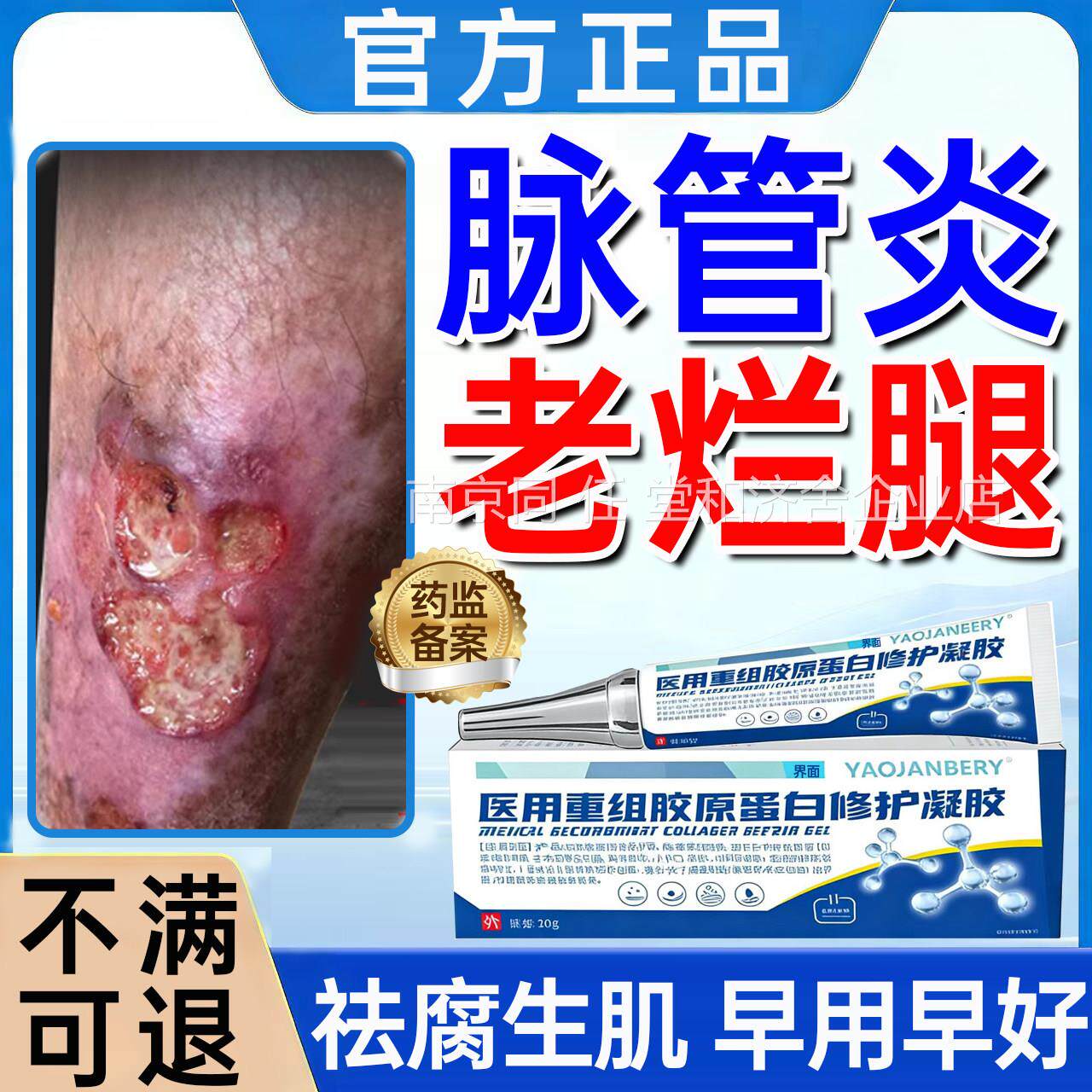 管炎老烂腿专用膏伤口愈脉合结痂下肢小腿溃烂发黑祛腐生肌凝胶UU