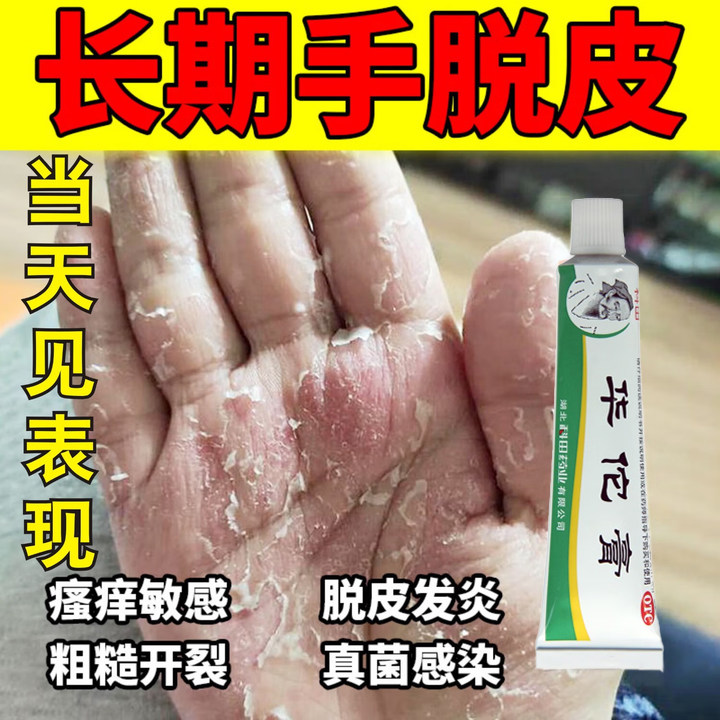 手癣膏脱皮干裂真菌感染手脱皮起皮手癣鹅掌风杀菌止痒华佗膏正品