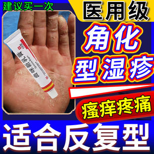 角化型手部濕疹藥膏曲咪新乳膏正品 白云山手指干裂脫皮真菌感染