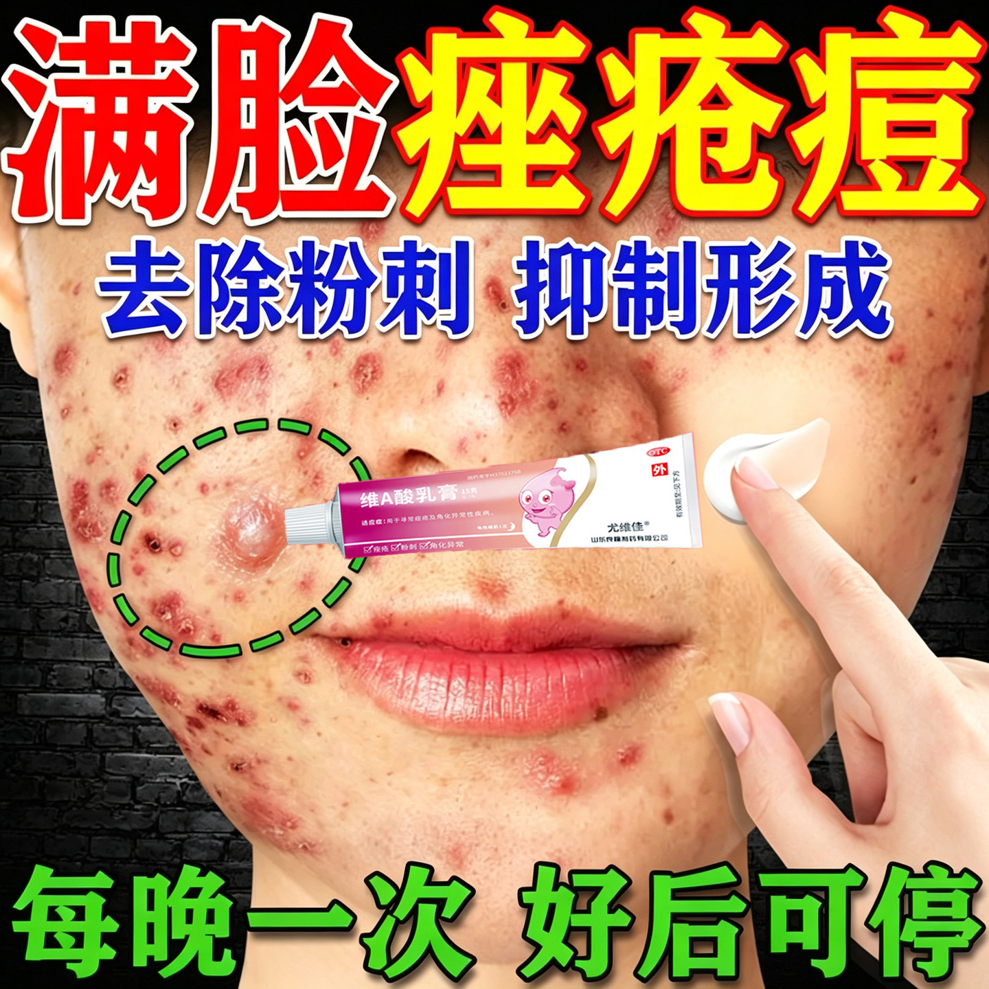 [良福]维A酸乳膏0.1%*15g*1支/盒