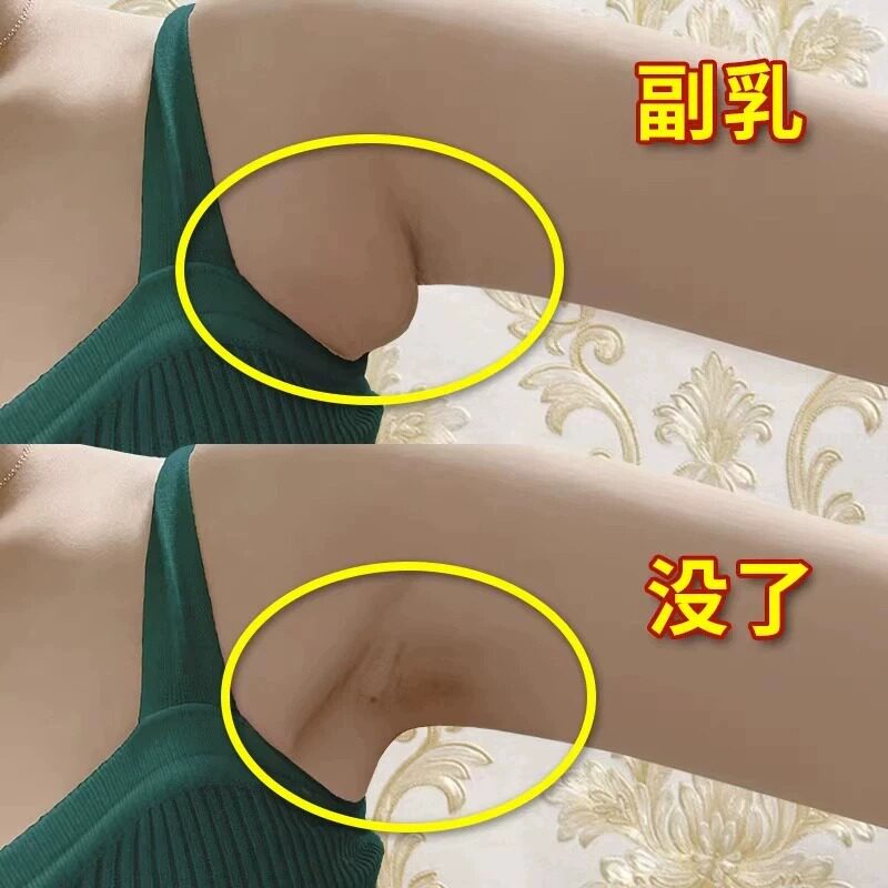 【屈臣氏热卖推荐】副乳消除贴腋下淋巴肿消散药贴去副乳神器