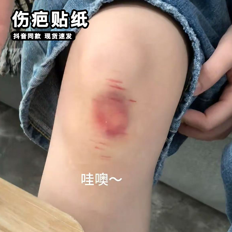 淤青纹身贴恶作剧仿真刮擦伤疤贴纸假装手受伤整蛊朋友病态贴