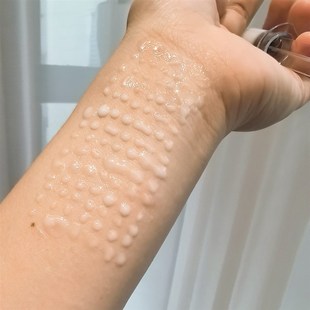 院线皮肤管理  焕肤开始 海绵微针扎扎霜细毛孔改善粉刺 亮白皮肤