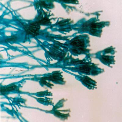 厌氧菌种污水处理菌种微益BE菌种治污菌种微生物菌种厂家