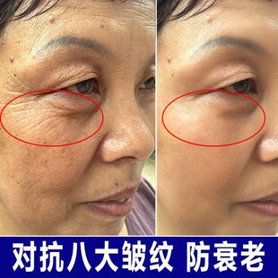 抗皱紧致面霜除皱纹神器皮肤提拉防皱霜除皱护肤品去邹纹霜抗衰老