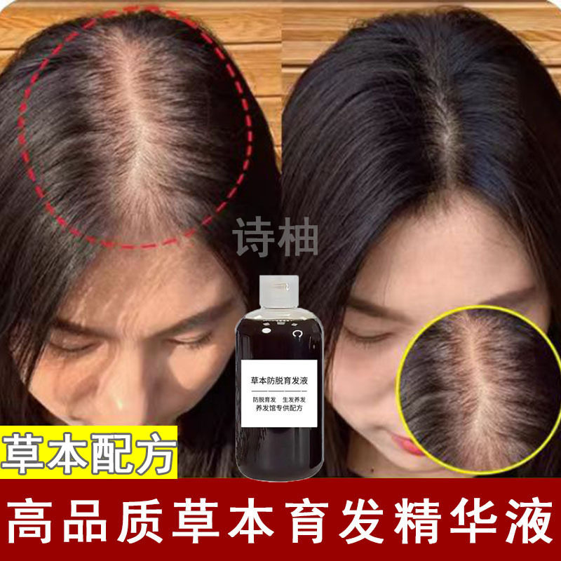 育发液增发密发修护发根头皮发际线密发蓬松植物防脱增发液生发液
