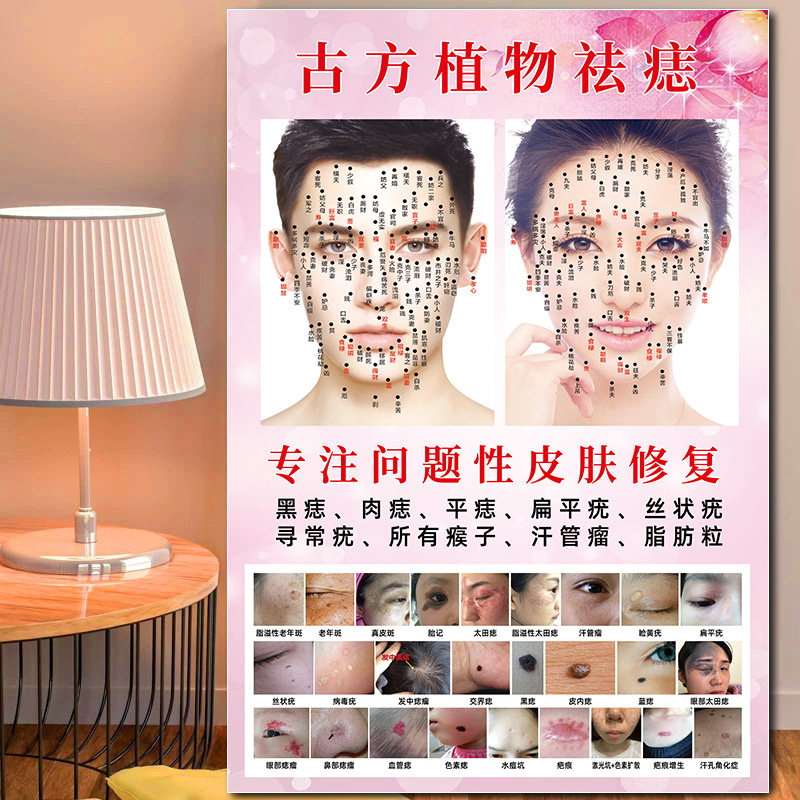 祛痣祛疣海报面部点痣图点痣宣传图男女面痣图广告痣相图去痣图片