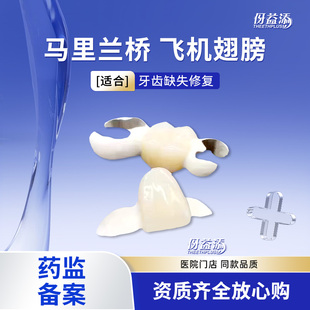 马里兰桥缺失牙定制全瓷牙定制美牙假临时牙固定粘接桥hpp粘接桥