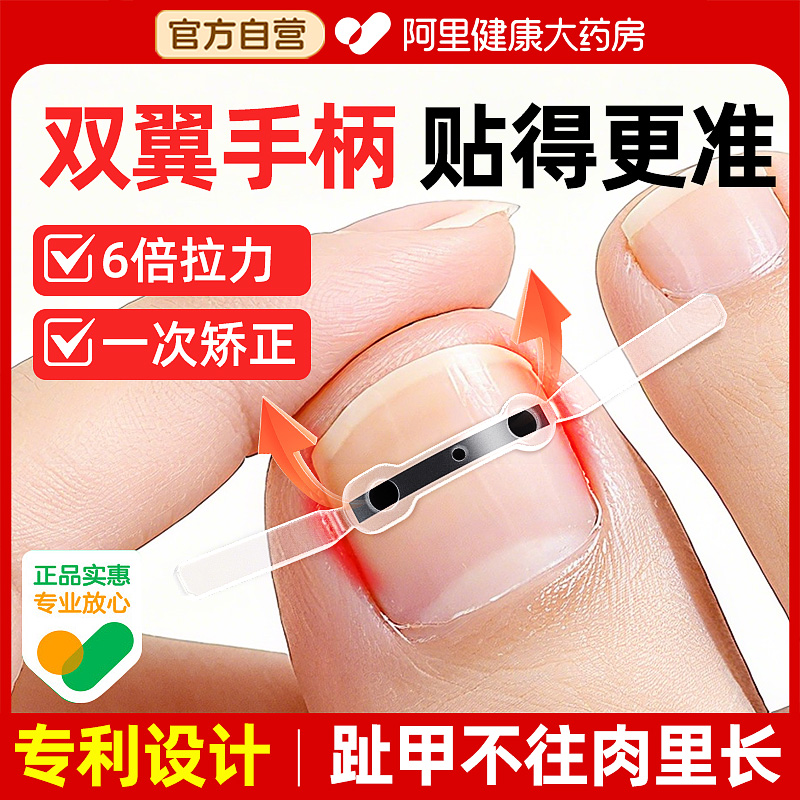 【双翼手柄操作简单】甲沟矫正