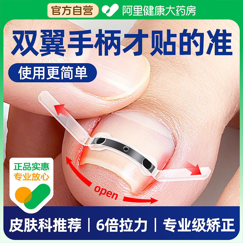 【医研级】双翼手柄甲沟矫正器