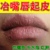 冶嘴唇起皮嘴唇干燥脱屑小孩嘴周红上火烂嘴干裂脱皮专用修复保湿