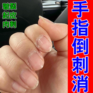 手指倒刺营养油修复神器防儿童指甲边翘皮死皮干裂脱皮裂护理油